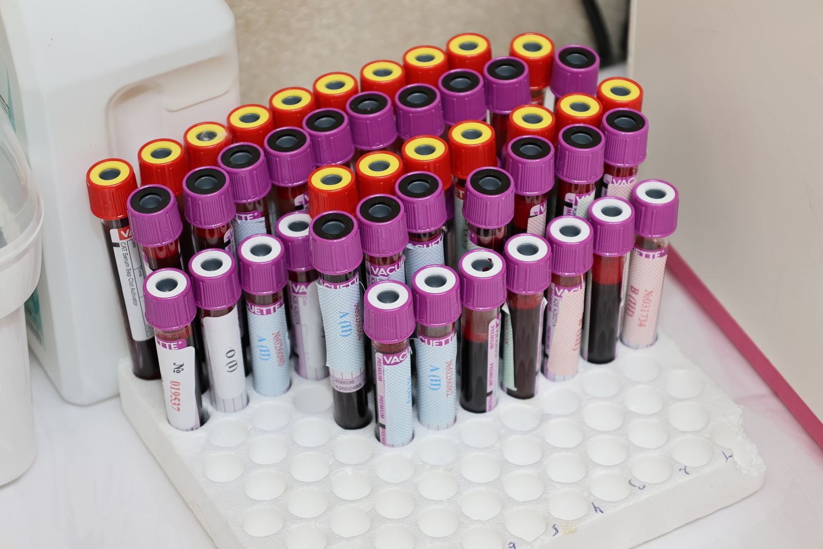 Tubos de coleta de sangue organizados em uma estante de laboratório, prontos para exames como o de TSH usado no diagnóstico do hipotireoidismo