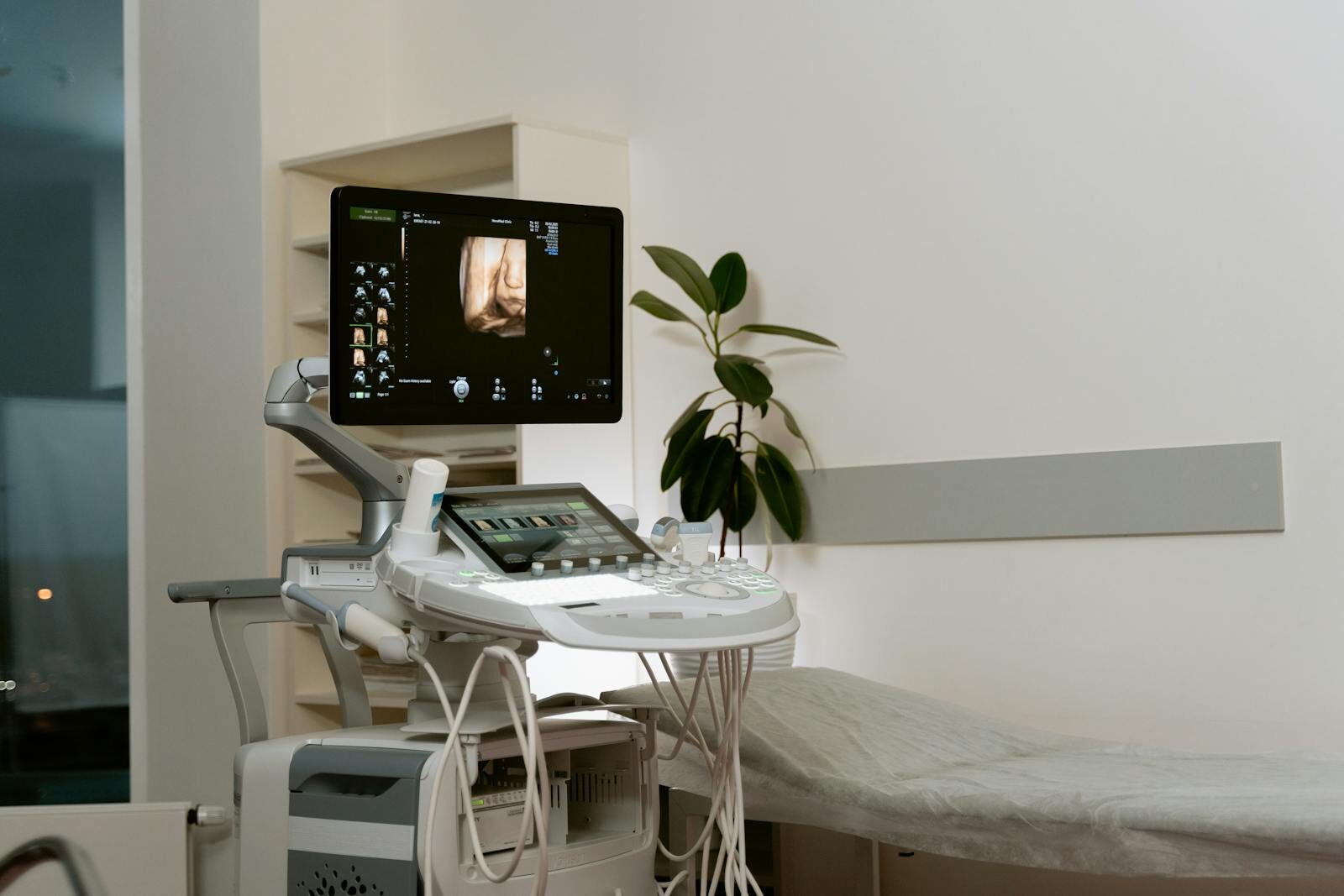 Aparelho de ultrassom moderno em sala de exame de clínica, com monitor exibindo imagem e maca ao lado